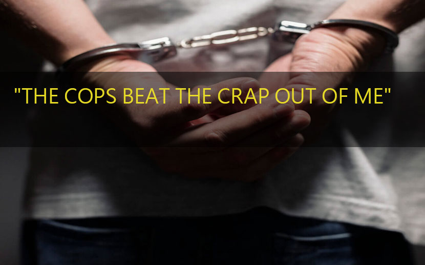 The Cops Beat the Crap Out of Me